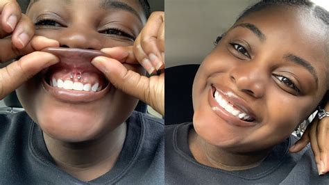 how long does the smiley piercing take to heal|Smiley (Frenulum) Piercing Information & Aftercare。